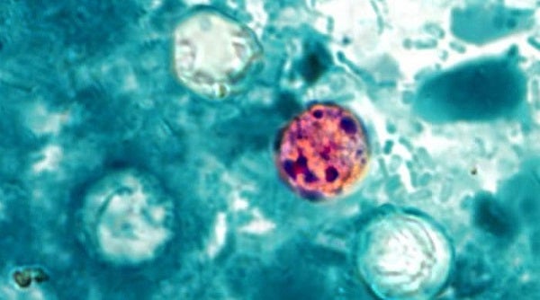 Cyclosporiasis CDC photo